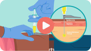 Key Steps to Inject